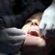 Sensitive Teeth Whitening Help Fort Worth